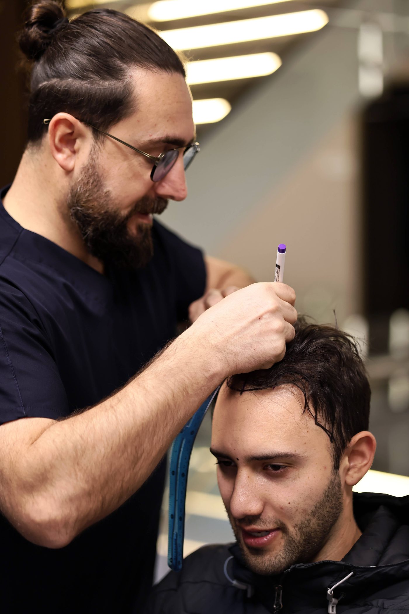 Transplantologe markiert vor dem Eingriff die Haarlinie für eine Haartransplantation nach der DHI-Methode