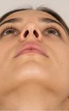 Beispielfoto: Nasenlöcher von unten