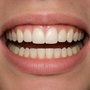 Beispielfoto: Lächeln frontal