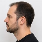 Beispielfoto: linkes Kopfprofil