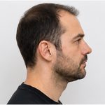 Beispielfoto: rechtes Kopfprofil