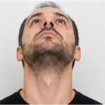 Beispielfoto: Kinn, Kopf nach oben geneigt